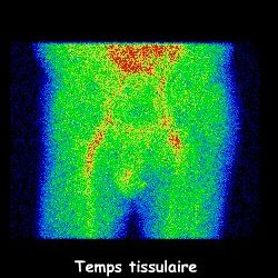 Temps tissulaire