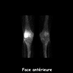 Genoux - face ant&eacute;rieure