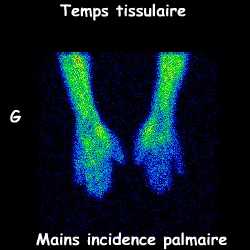 Temps tissulaire