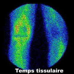 Temps tissulaire