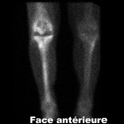 Temps osseux - Face ant&eacute;rieure