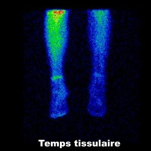 Temps tissulaire