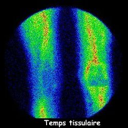 Temps tissulaire