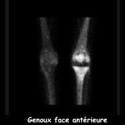 Temps osseux - Face ant&eacute;rieure