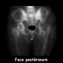 Bassin - Face post&eacute;rieure