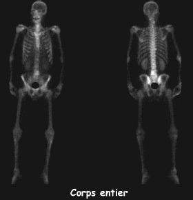 Corps entier