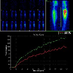 Temps vasculaire