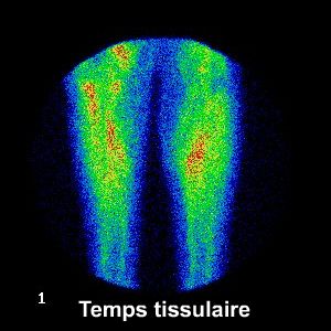Temps tissulaire