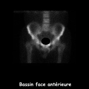 Bassin face ant&eacute;rieure