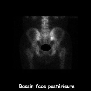 Bassin face post&eacute;rieure