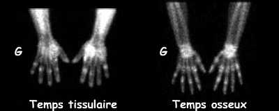 Clich&eacute;s centr&eacute;s sur les mains