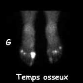 Clich&eacute;s centr&eacute;s sur les pieds