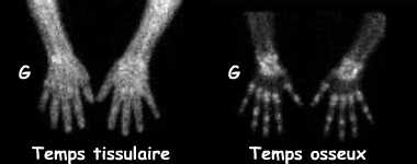 Temps tissulaire et temps osseux