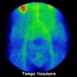Temps tissulaire