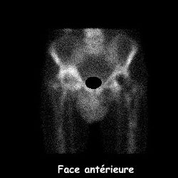 Temps osseux - Face ant&eacute;rieure