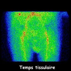 Temps tissulaire