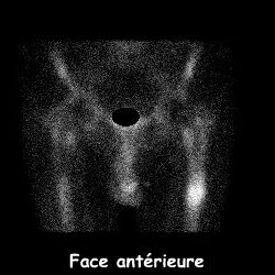 Temps osseux - Face ant&eacute;rieure