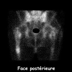 Temps osseux - Face posterieure