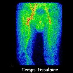 Temps tissulaire