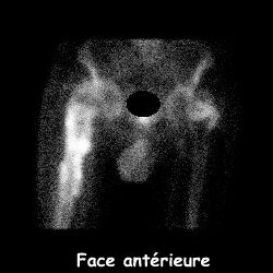 Temps osseux - Face ant&eacute;rieure