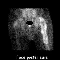 Temps osseux - Face post&eacute;rieure