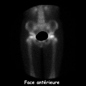 Bassin - Face ant&eacute;rieure