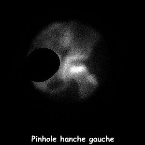 Clich&eacute; pinhole hanche gauche