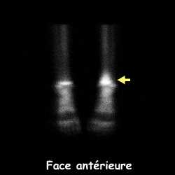 Face ant&eacute;rieure jambes