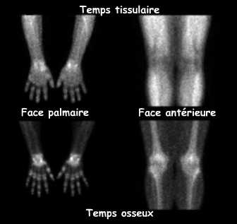 Clich&eacute;s centr&eacute;s