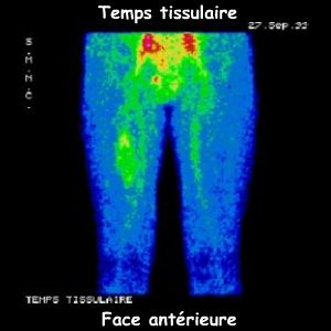 Temps tissulaire
