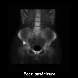 Bassin - Face ant&eacute;rieure