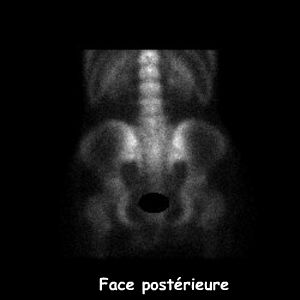 Bassin - Face post&eacute;rieure
