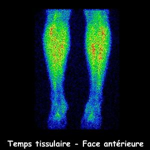 Temps Tissulaire - Face ant&eacute;rieure
