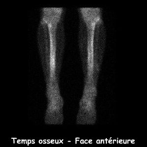 Temps osseux - Face ant&eacute;rieure