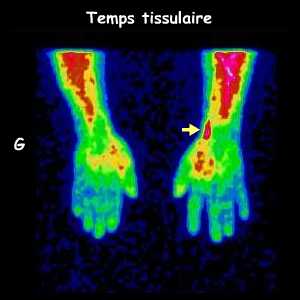 Temps tissulaire