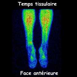 Temps tissulaire