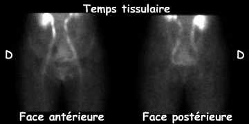 Temps tissulaire