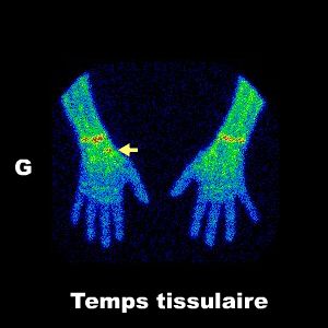 Temps tissulaire