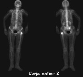 Corps entier 2