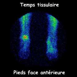 Pieds face ant&eacute;rieure - Temps tissulaire