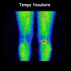 Temps tissulaire