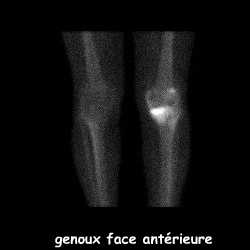 Temps osseux - Face ant&eacute;rieure
