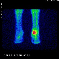 Temps tissulaire