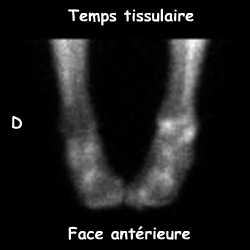 Temps tissulaire