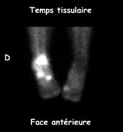 Temps tissulaire