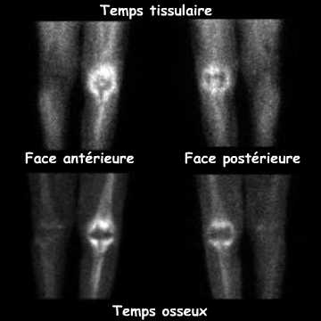 Temps tissulaire et temps osseux
