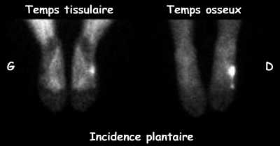 Temps tissulaire et temps osseux