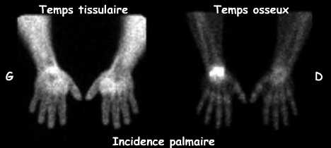 Temps tissulaire et temps osseux