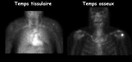 Temps tissulaire et temps osseux