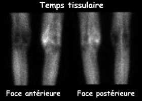 Temps tissulaire